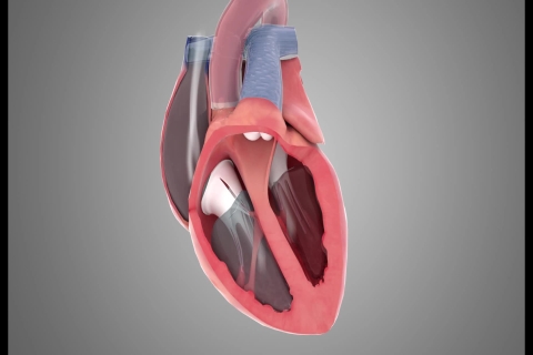 医学医疗动画-心脏跳动及剖面·案例